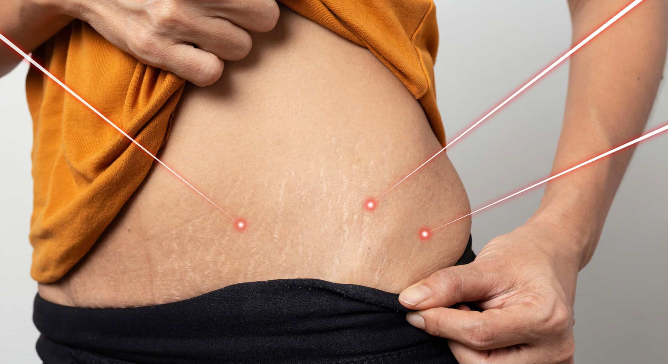 Projekt Bildgröße ändern